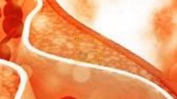 शरीर मे दिखने लगे ये 7 संकेत तो बढ़ रहा है आपका केलोस्ट्रोल