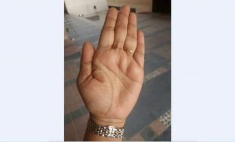 Minor Health Issues in Middle Age