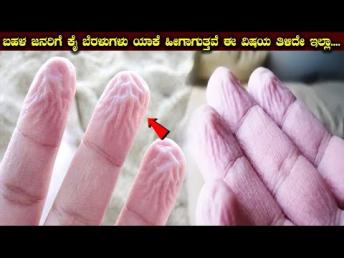 ಬಹಳ ಜನರಿಗೆ ಕೈ ಬೆರಳುಗಳು ಯಾಕೆ ಹೀಗಾಗುತ್ತವೆ ಈ ವಿಷಯ ತಿಳಿದೇ ಇಲ್ಲಾ....