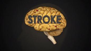 What is Brain Stroke