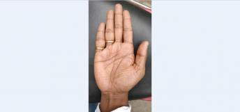 Long Progress Line on Jupiter Mount