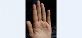 Weak Mercury Mount on Female Hand