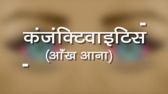 आँख आना कंजंक्टिवाइटिस क्या है