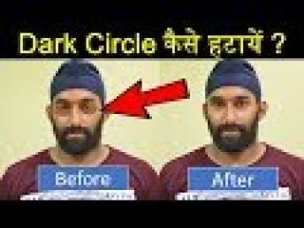 How to Remove Dark Circles Naturally  Reasons of Dark Circle Hindi