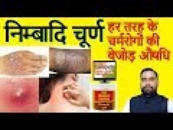 Nimbadi Churna | निम्बादि चूर्ण हर तरह के चर्मरोगों की बेजोड़ औषधि
