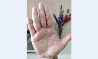 Straight Life Line Sometimes Give Spine Problems