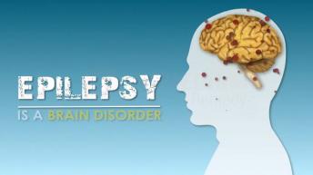 What is Epilepsy