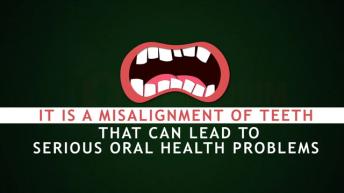 What is Crooked Teeth