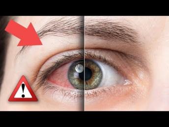 Health Benefits of Guava | Health Tips in Kannada ದಿನಕ್ಕಿ ಒಂದು ಸೀಬೆಕಾಯಿ ತಿಂದರೆ ಏನಾಗುತ್ತೆ ಗೊತ್ತಾ