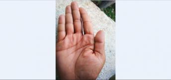 Low Set and Weak Jupiter Mount