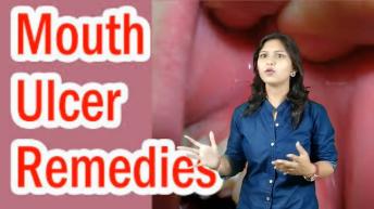 मुह के छालों को दूर करने वाले असरदार उपाय | Mouth Ulcer Treatment Tips