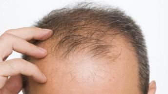 बाल झड़ना तुरंत बंद खा लें इनमें से कोई भी 1 चीज