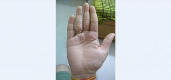 Break in Life Line is Not Good