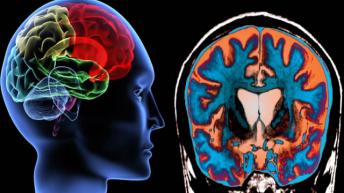 ये खाओगे तो लोहे से भी कडी और मजबूत बन जायेंगी कमजोर हड्डियां  Get Strong Boons Naturally