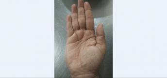 Weak Mercury Mount Decreases Busines Acumen