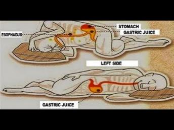 ಎಡಮಗ್ಗುಲಲ್ಲಿ ಮಲಗುವುದರಿಂದ ಏನಾಗುತ್ತೆ ? ಒಂದು ಬಾರಿ ಈ ವಿಡಿಯೋ ನೋಡಿ Health benefits of left side sleeping