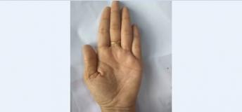 झुकी हुई मस्तिष्क रेखा दे सकती है तनाव