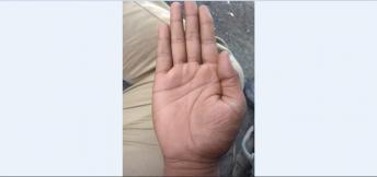 Weakness In Health In Later Age