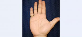 Medical Stigmata and Ring of Soloman