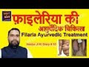 Filaria Treatment | फ़ाइलेरिया की आयुर्वेदिक चिकित्सा वैद्य जी की डायरी #10